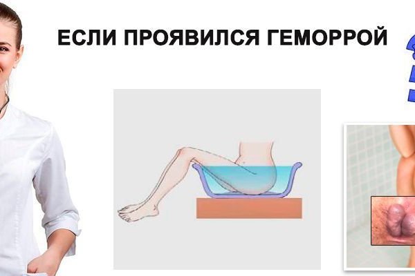 Кракен тор krakendark krakendark link
